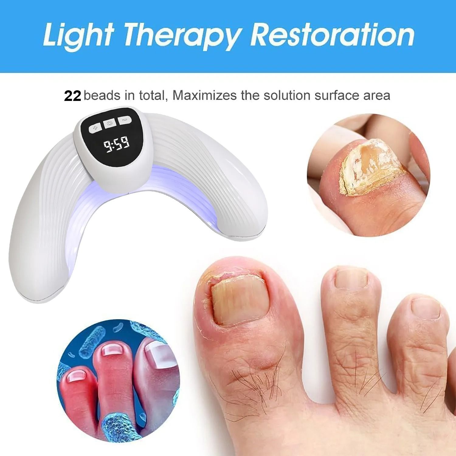 Laser Nail Fungus Treatment Device for Healthy Toenails and Fingernails