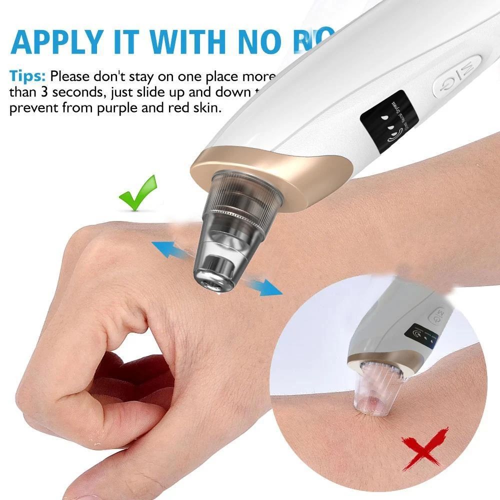 Electric Facial Blackhead Vacuum Cleaner