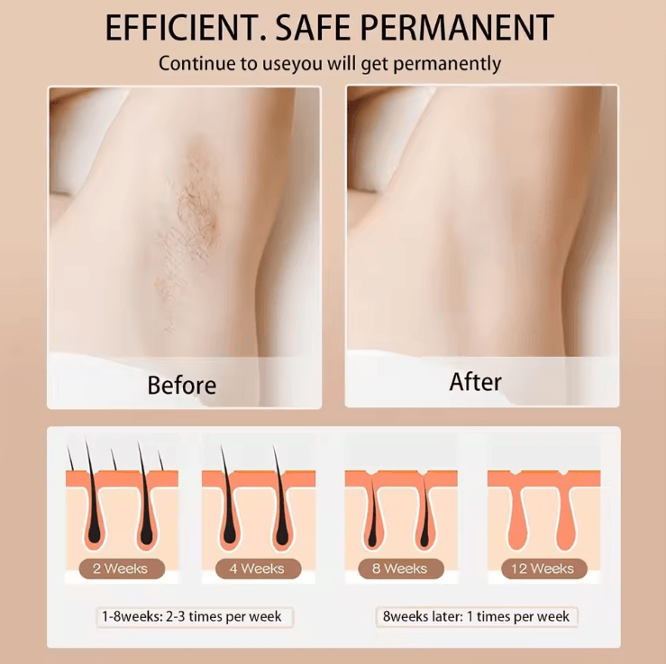 SmoothGlow IPL Hair Removal Device 990000 Flashes for Permanent Results