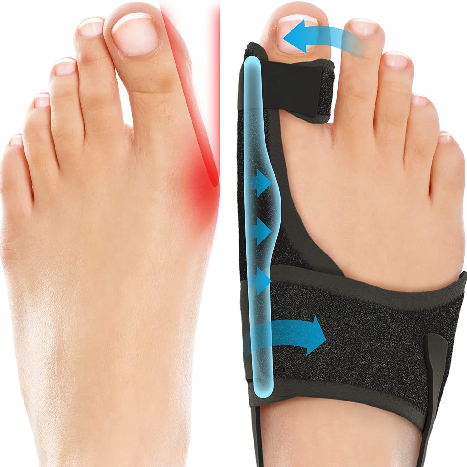 Non-surgical Orthopedic Bunion Splint, Big Toe Separator, Hammer Toe Straightener, Pain Relief