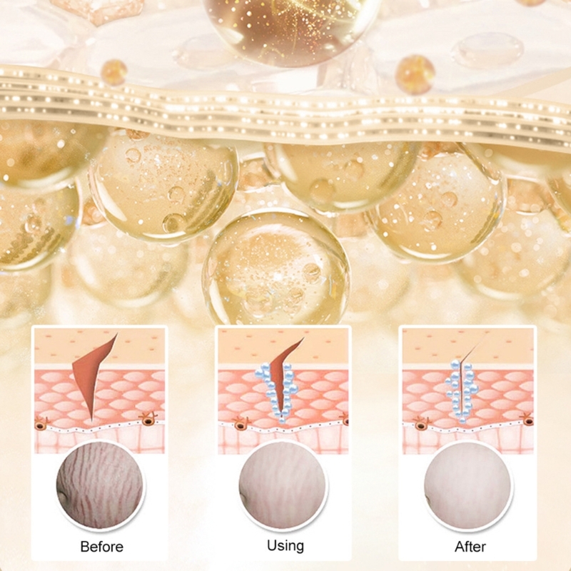 Postpartum Repair Essential Oil, Fade Stretch Marks Fat Lines, Big Belly Recovery Body Massage Oil Skin Whitening Care