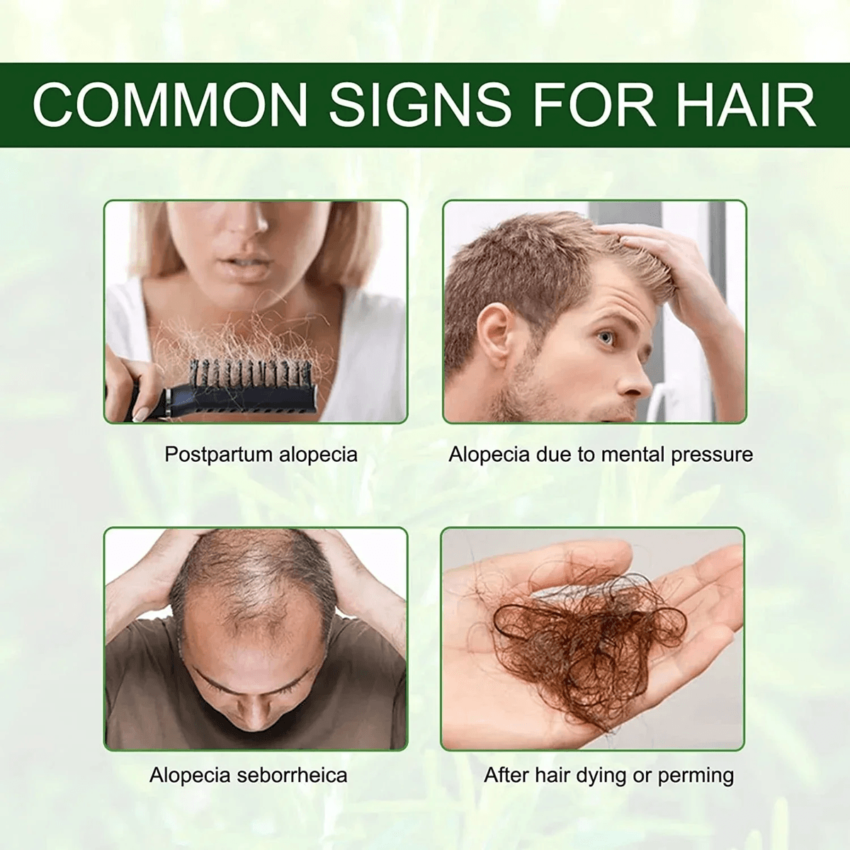 Fast-Acting Hair Growth Oil – Natural Anti Hair Loss Serum for Baldness and Postpartum Regrowth
