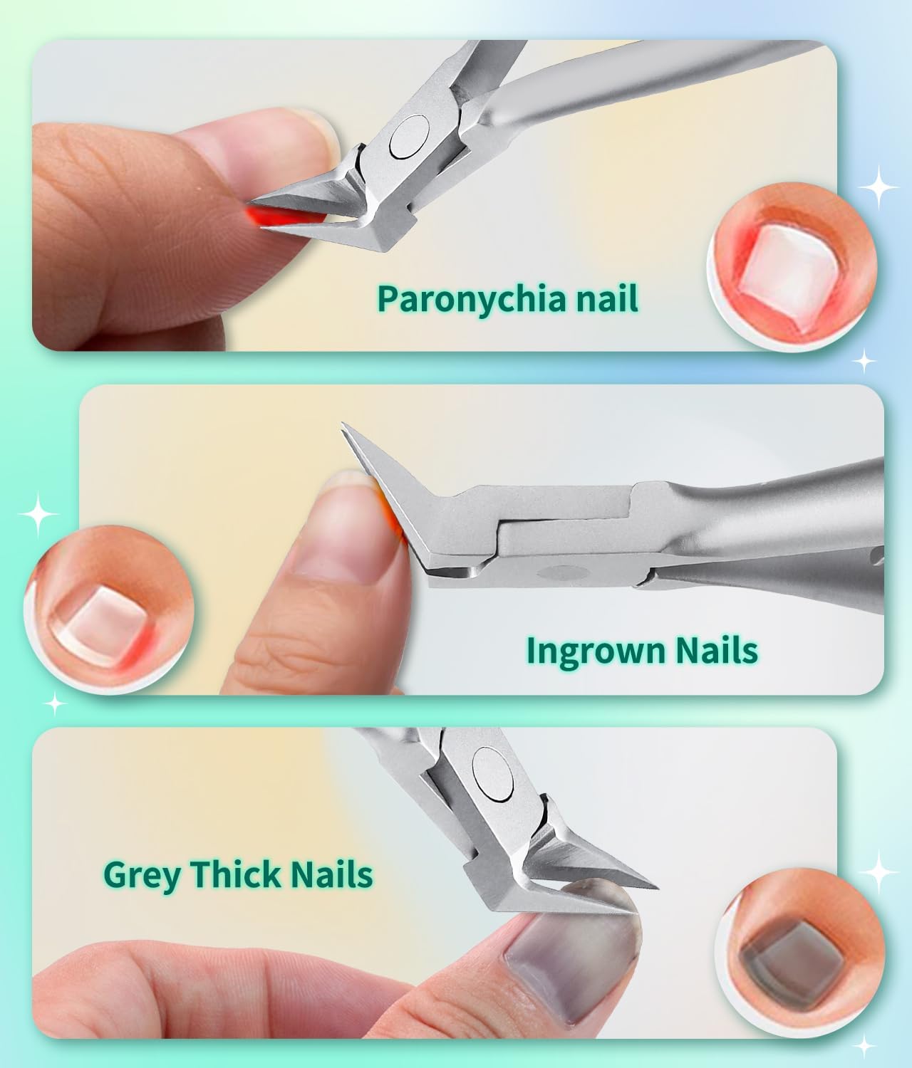 ProPed Nail Nipper ingrown toenail clipper & thick toenail nipper with surgical grade stainless steel