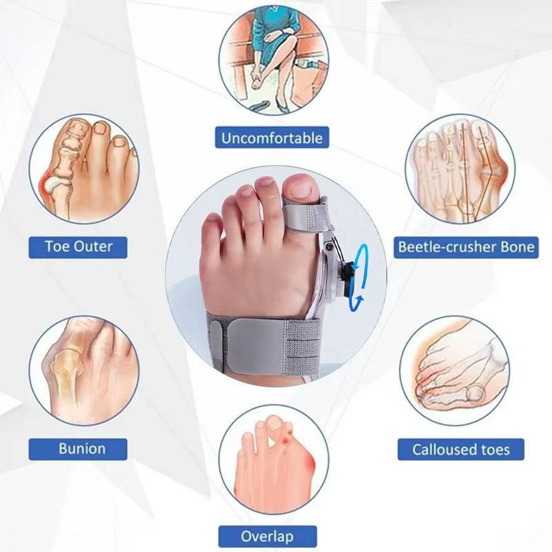 Bunion Corrector Unisex Hallux Valgus Brace – Adjustable Rotatable Toe Separator & Foot Straightener