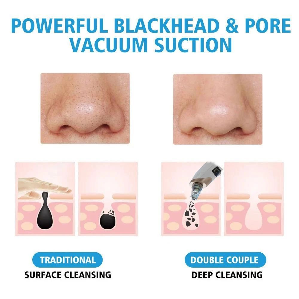 Electric Facial Blackhead Vacuum Cleaner