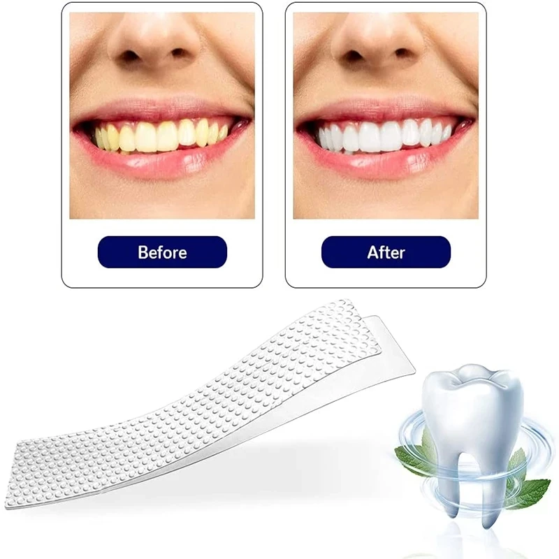 Teeth Whitening Strips Kit Fast Stain Removal Dental Whitening Strips