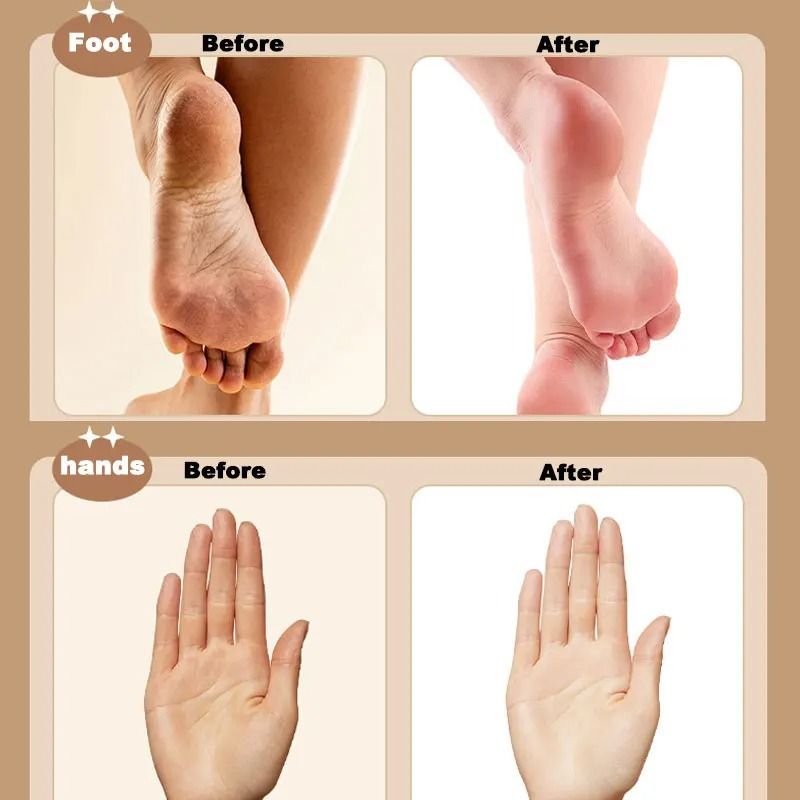 3 In 1 Electric Foot File Callus Remover