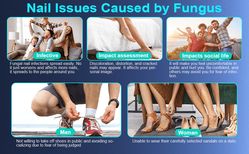 Nail Fungus Laser Therapy Device, Safe, Painless At-Home Nail Care