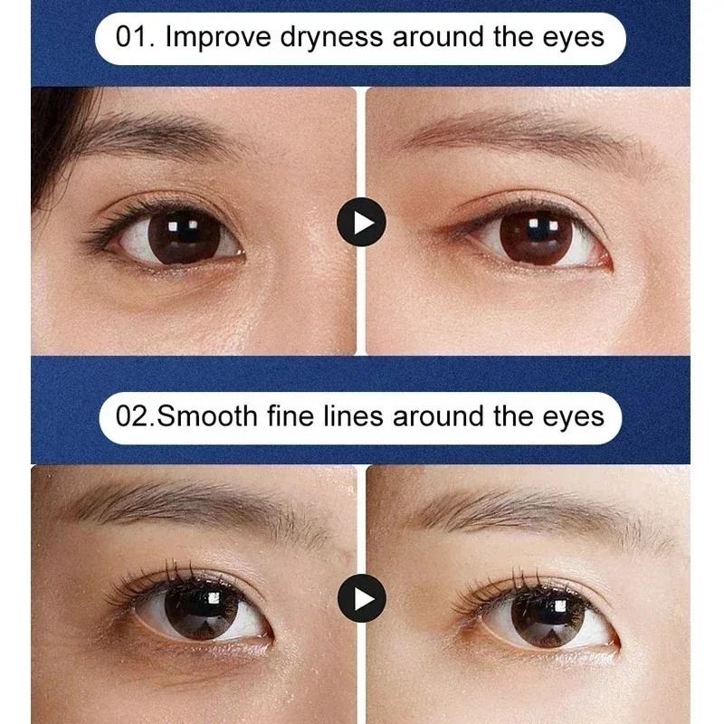 Advanced Home Facial Lifting and Rejuvenation Device