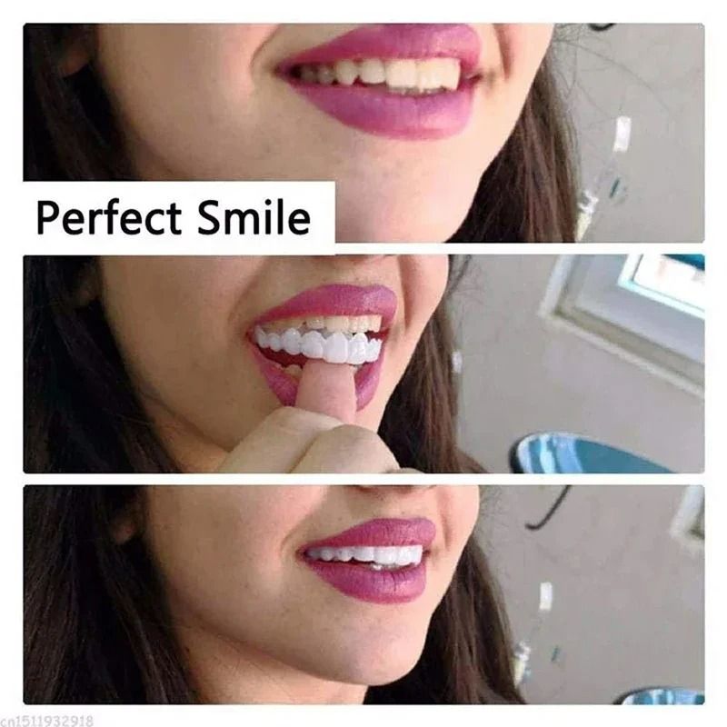 Veneer Snap-on Teeth Kit Fake Temporary Tooth Whitening Replacement White Snap Repair Fitting Kit