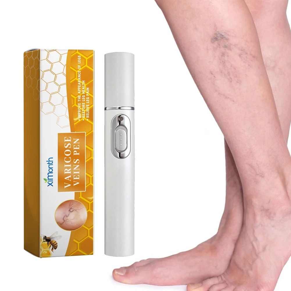 Varicose Vein Relief Pen for Soothing Leg Discomfort and Promoting Circulation