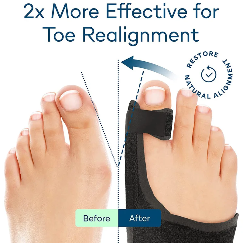 Non-surgical Orthopedic Bunion Splint, Big Toe Separator, Hammer Toe Straightener, Pain Relief