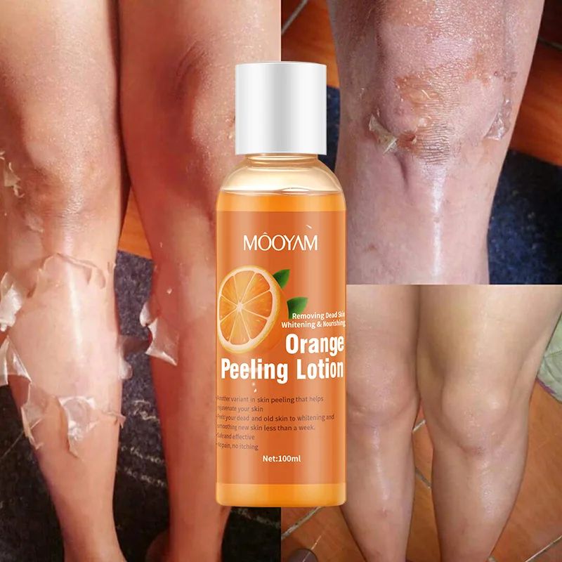 100ml Orange Peeling Oil Moisturizing Foot Exfoliator for Rough Elbows, Knees & Heels