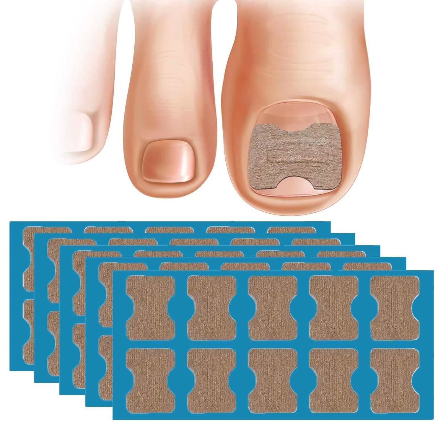 50 and 100 Pcs Nail Correction Stickers for Ingrown Toenail Care