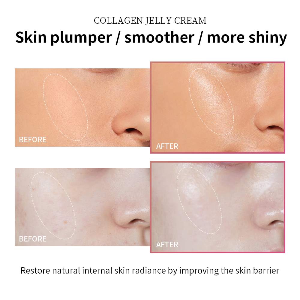 Moisturizing Collagen Jelly Cream, Niacinamide, Hydrolyzed Collagen, Tightening Soothing Anti Aging, Firmness Hydration