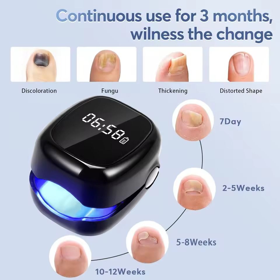 Wireless Nail Fungus Laser Therapy Device with Blue Light and Ultra-Pulsed Laser