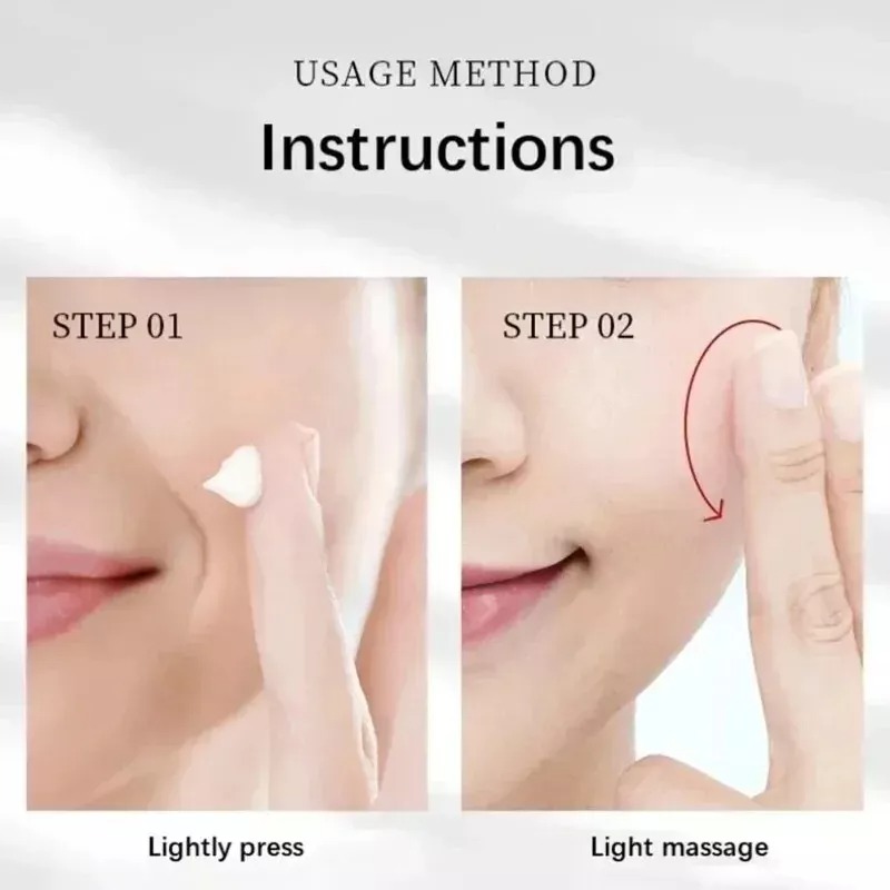 Effective Whitening Freckle Cream Remove Dark Spot Cream Removal Melanin Melasma