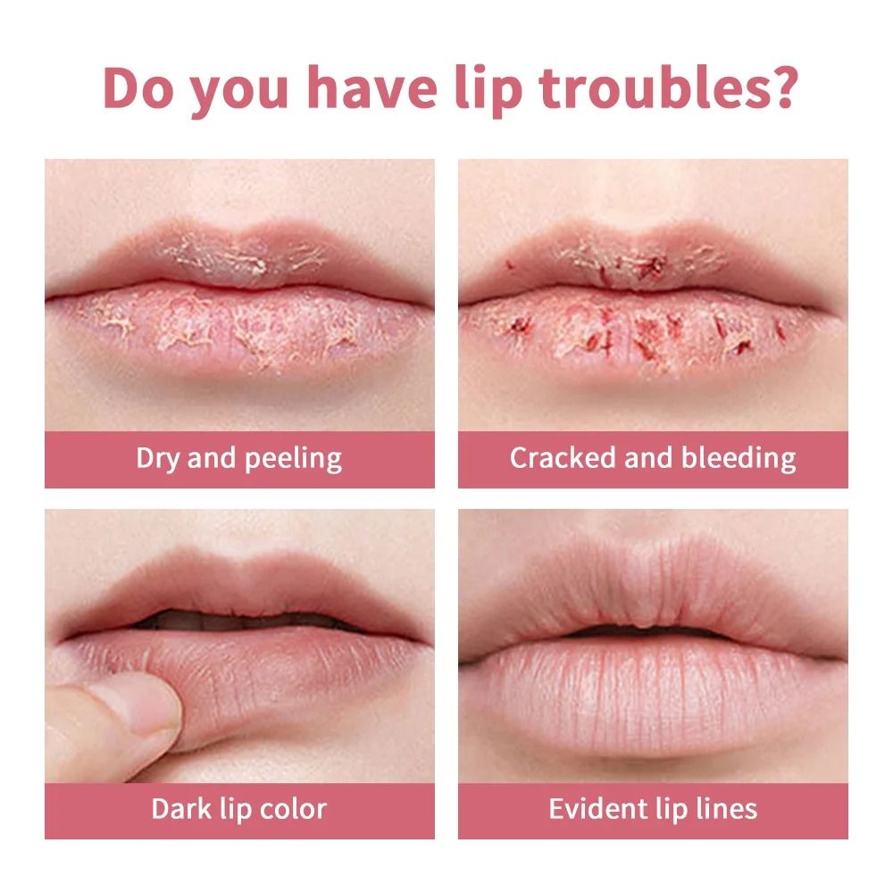 Honey Infused Pink Tinted Lip Balm – Intensive Repair & Powerful Lip Repulper