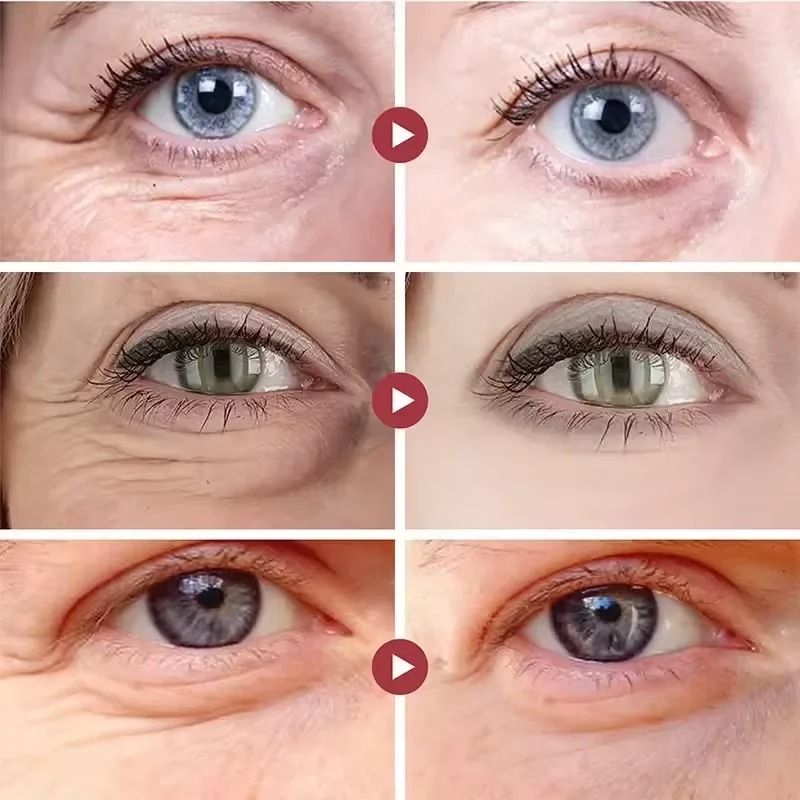 Instant Eye Bag Recovery Cream – Retinol Infused Anti-Wrinkle & Firming Therapy