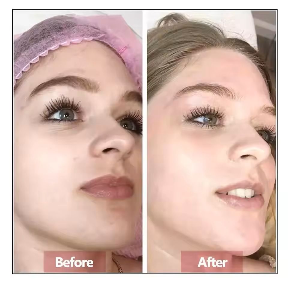 Hyaluronic Acid Facial Serum Skin Rejuvenation Essence