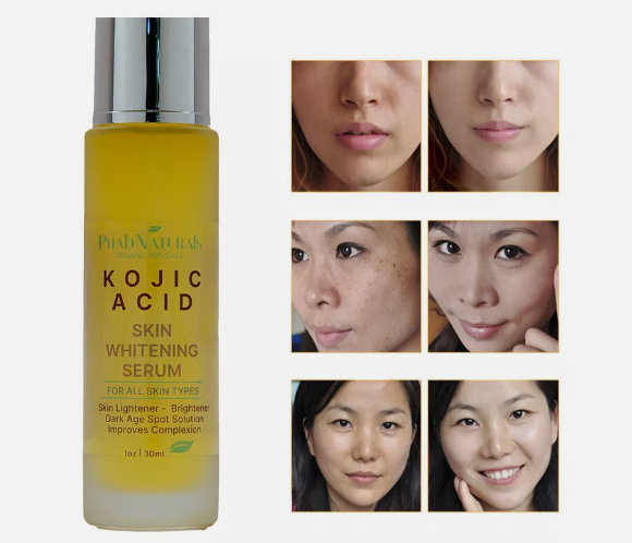 Kojic Acid Skin Whitening Lightening Brightening Serum Bleaching Spot Fade Cream
