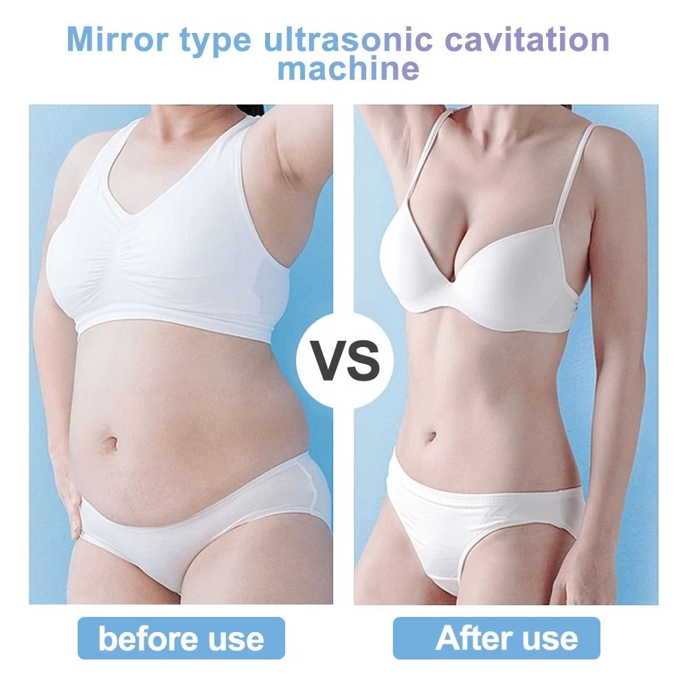 4 in 1 Cavitation Slimming and Skin Tightening Ultrasonic Device