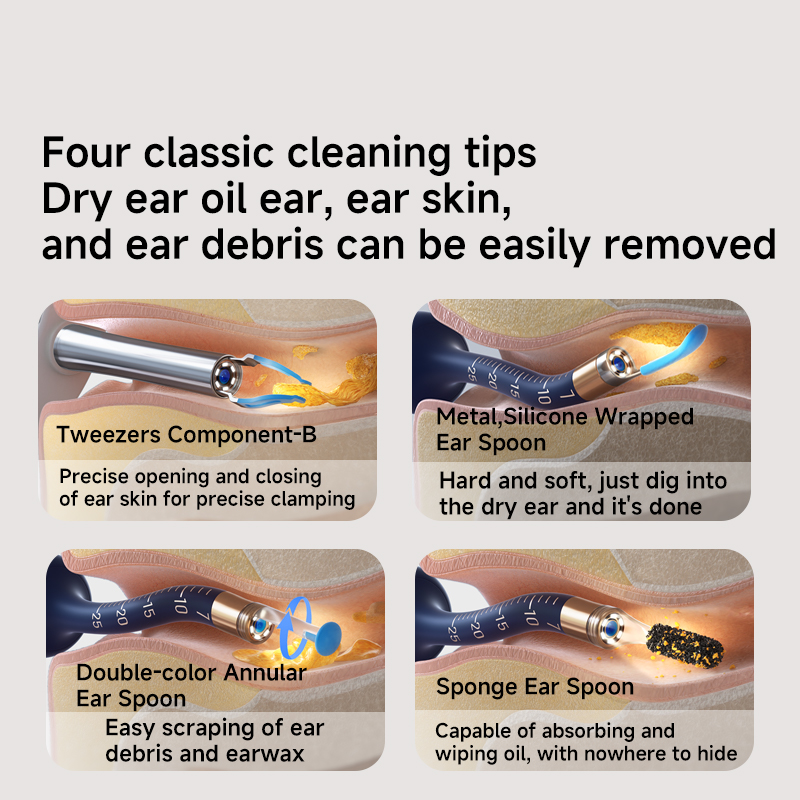 EarSight Plus Earwax Removal Kit, 1080P Camera, Bendable Ear Rod, & FDA-Certified Silicone Spoons