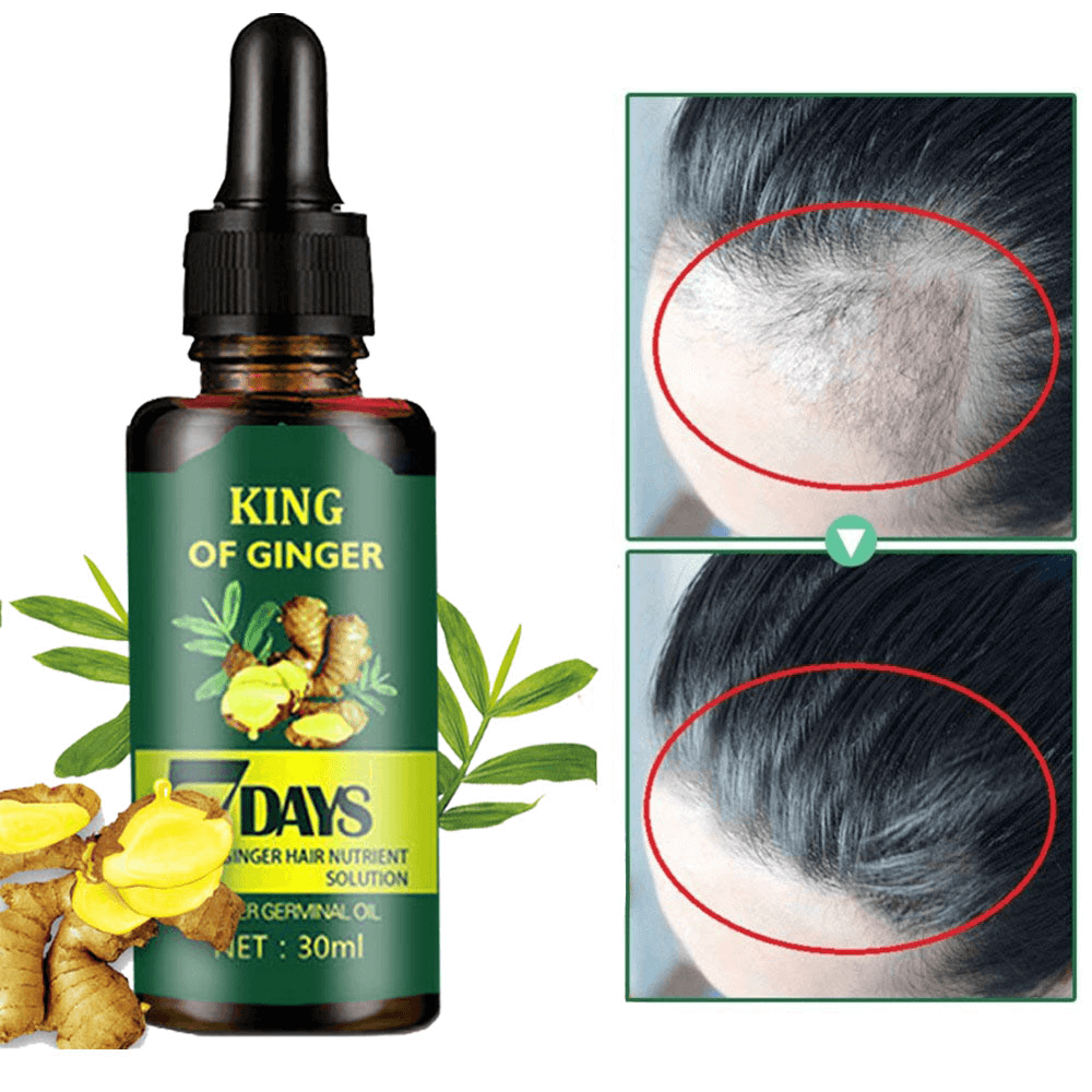 7 Day Hair Regrowth Serum