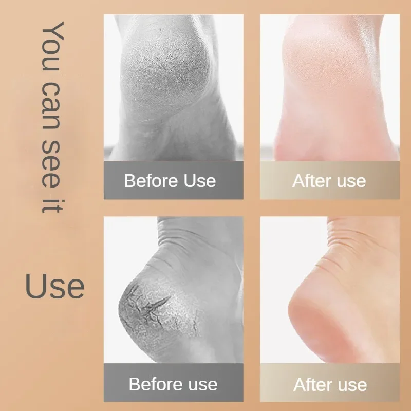 Heel Protective Foot Cover Socks Silicone Anti-Crack Moisturizing Pain Relief Socks Unisex Feet Care