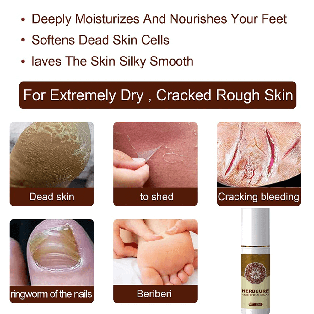 Anti-Fungal Treatment Spray