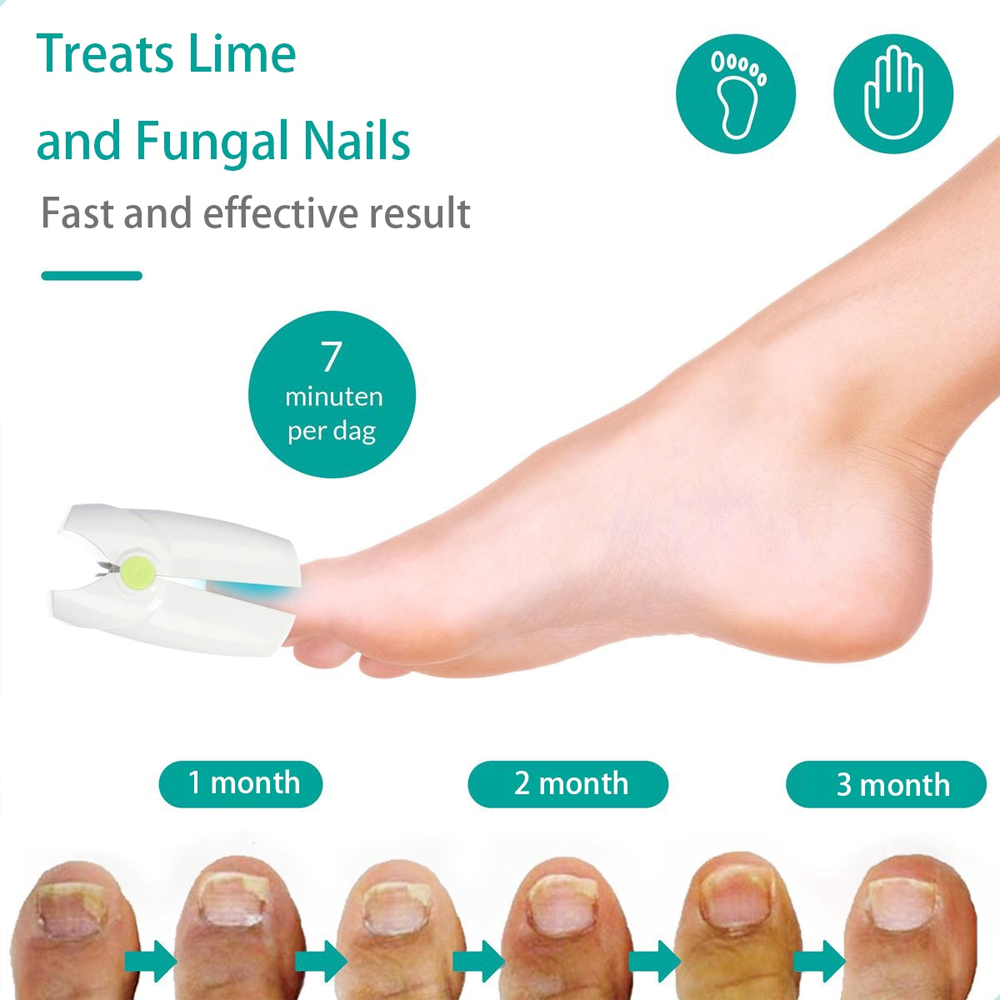 Nail Fungus Laser Device