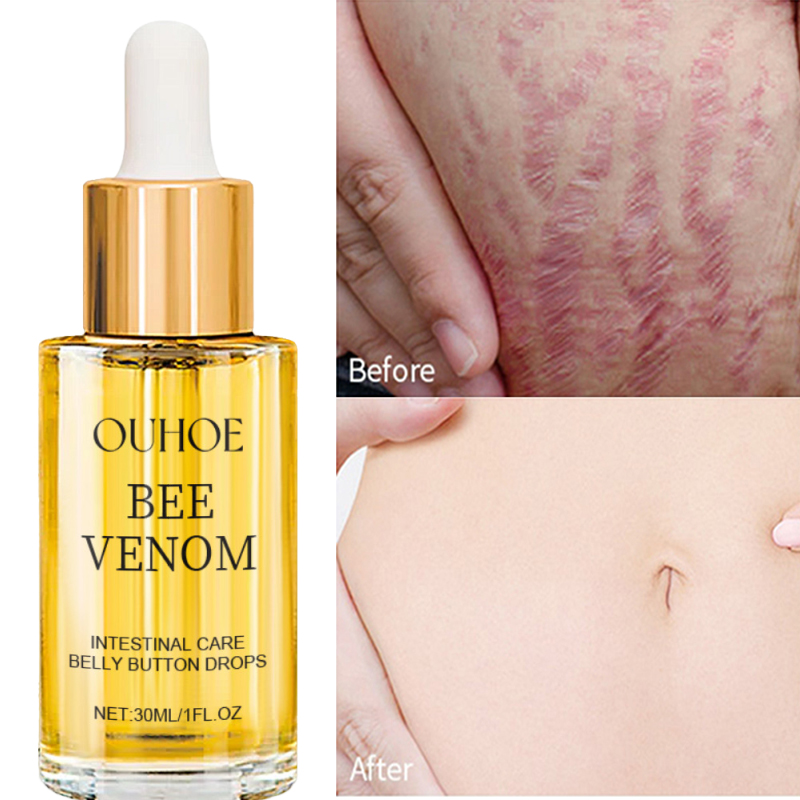 Postpartum Repair Essential Oil, Fade Stretch Marks Fat Lines, Big Belly Recovery Body Massage Oil Skin Whitening Care