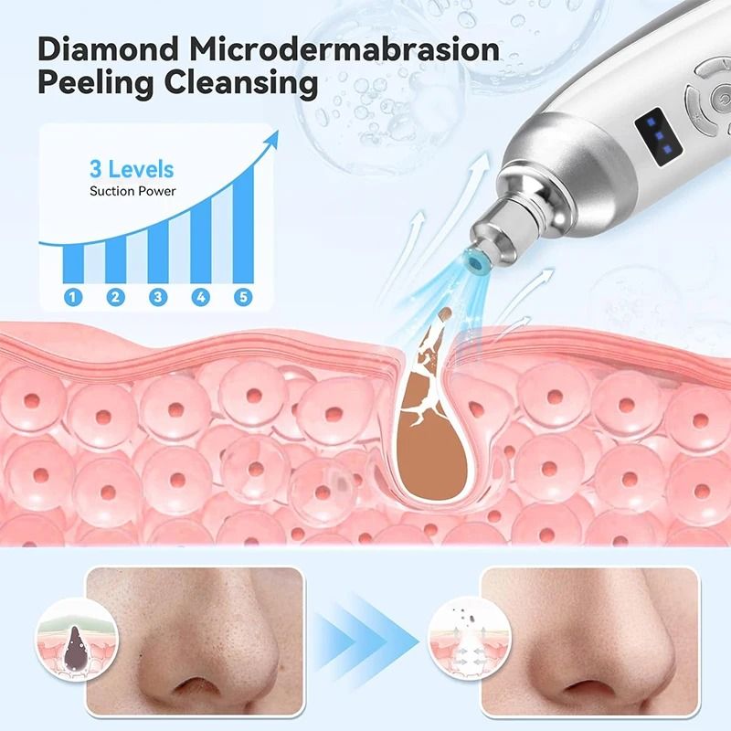 Upgraded Diamond Microdermabrasion Machine Professional Blackhead Removal and Facial Skin Care Device