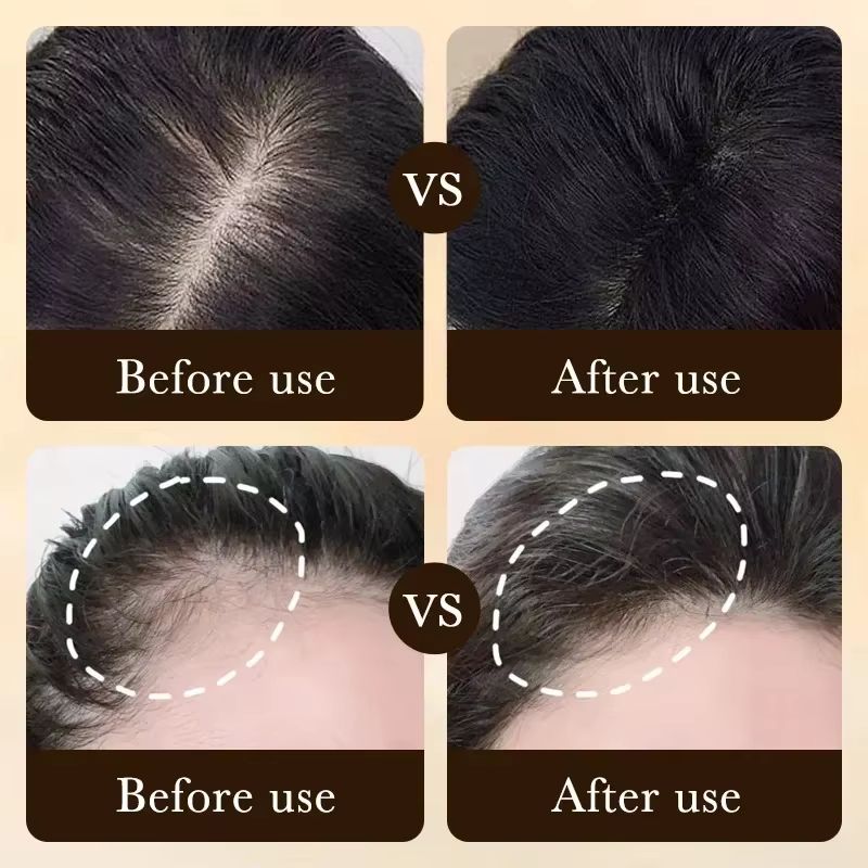 Vita Thick Biotin-Boost Hair Growth Oil – Intensive Scalp & Hair Loss Repair Treatment