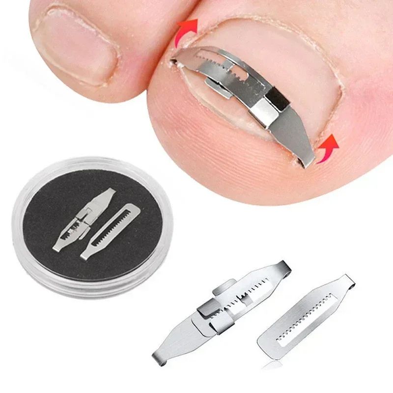 Professional Ingrown Toenail Corrector Tool Set for Pain-Free Pedicure Care