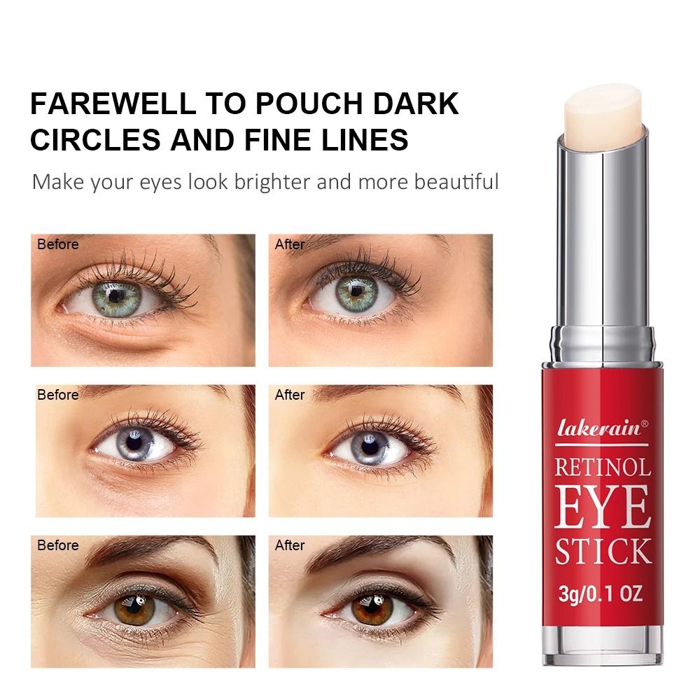 Retinol Anti-Wrinkle Eye Treatment – Multi-Action Lifting & Dark Circle Repair