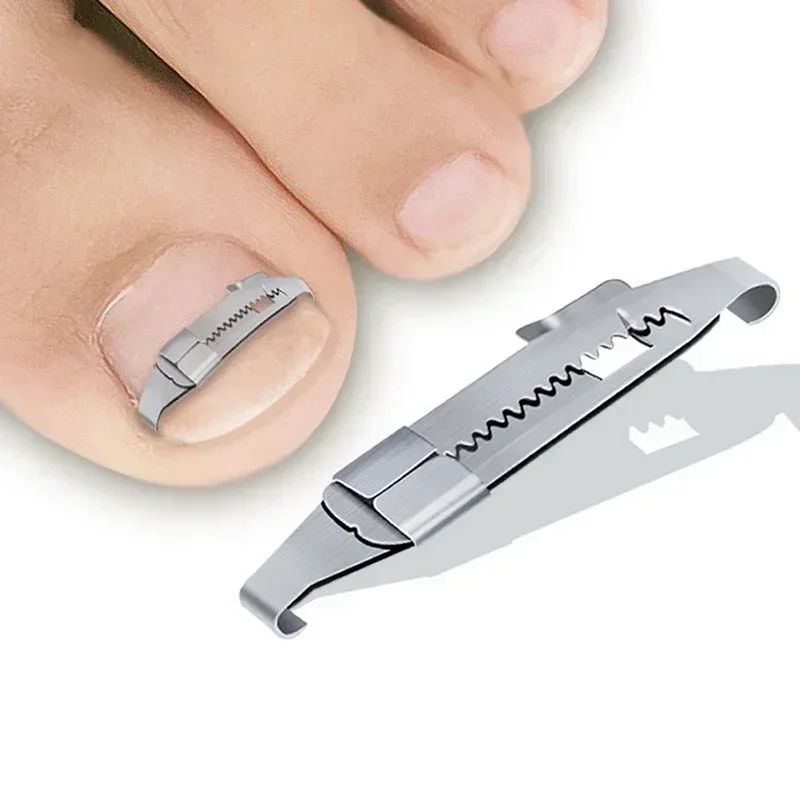 Professional Ingrown Toenail Corrector Tool Set for Pain-Free Pedicure Care
