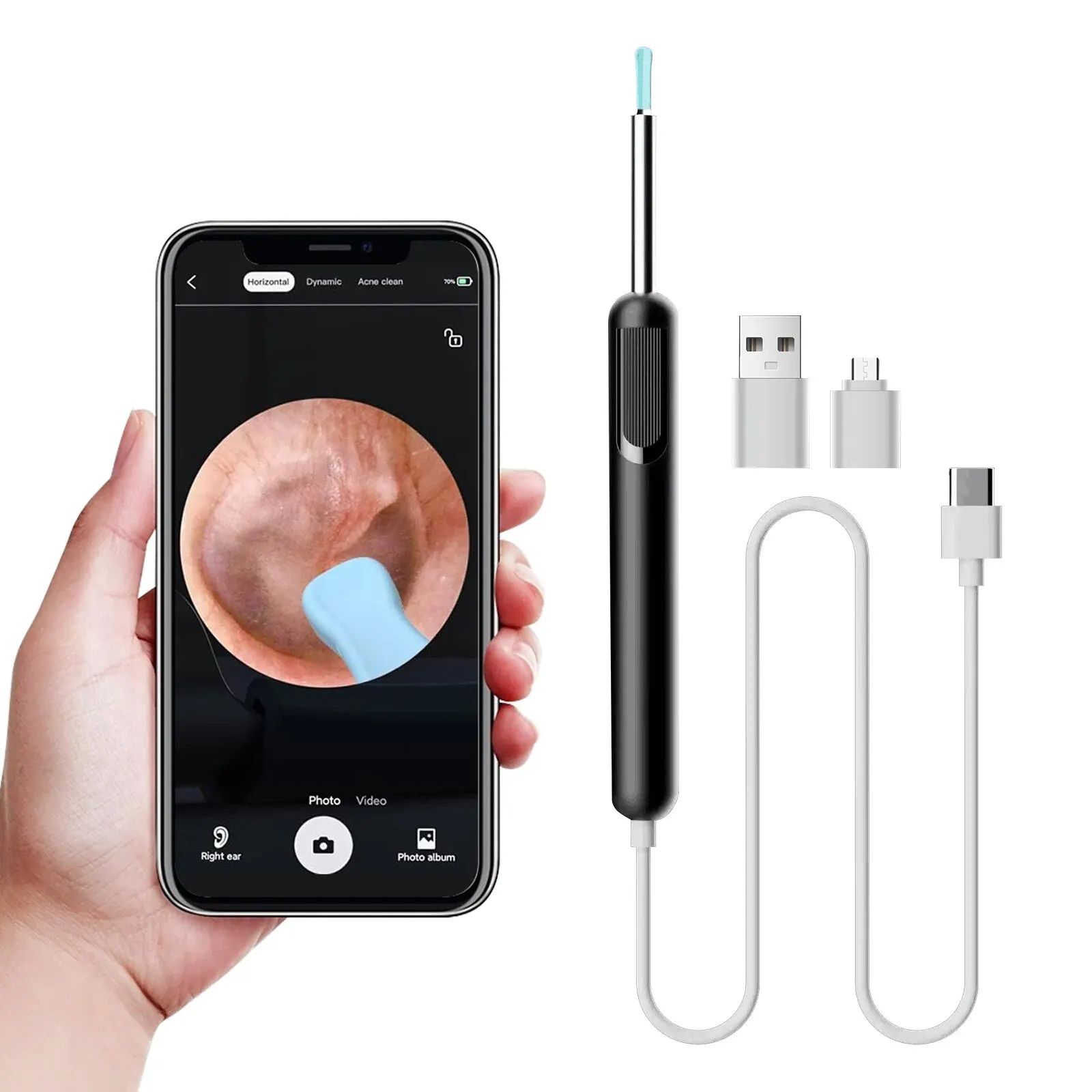 Smart Ear Camera Otoscope – HD Ear Wax Removal Tool for Android & PC