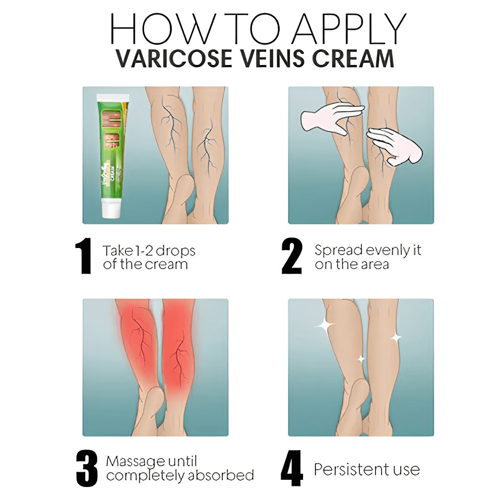 Vein Smoothing Varicose Veins Cream
